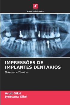 Paperback Impressões de Implantes Dentários [Portuguese] Book