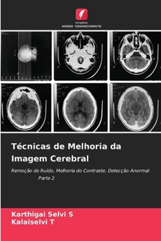 Paperback Técnicas de Melhoria da Imagem Cerebral [Portuguese] Book