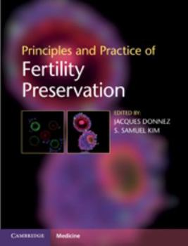 Hardcover Principles and Practice of Fertility Preservation Book