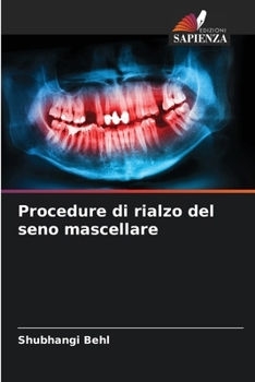 Paperback Procedure di rialzo del seno mascellare [Italian] Book