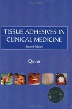 Hardcover Tissue Adhesives in Clinical Medicine: [With CDROM] Book