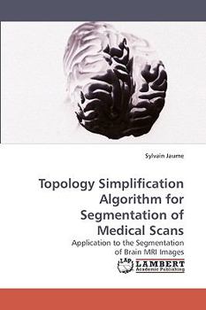 Paperback Topology Simplification Algorithm for Segmentation of Medical Scans Book