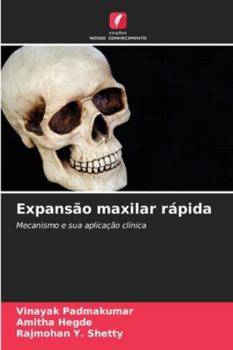 Paperback Expansão maxilar rápida [Portuguese] Book