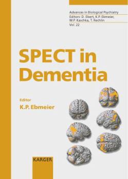 Hardcover Spect in Dementia (Advances in Biological Psychiatry) Book
