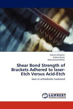 Paperback Shear Bond Strength of Brackets Adhered to laser-Etch Versus Acid-Etch Book