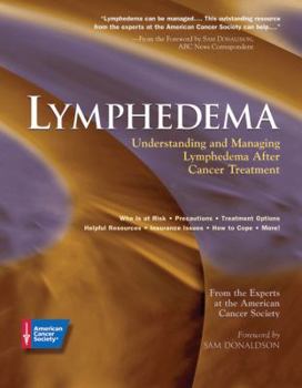 Paperback Lymphedema: Understanding and Managing Lymphedema After Cancer Treatment Book