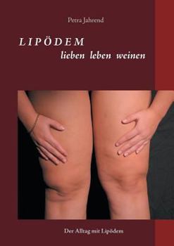 Paperback Lipödem - lieben leben weinen: Der Alltag mit Lipödem [German] Book