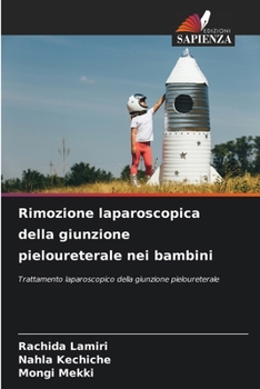 Paperback Rimozione laparoscopica della giunzione pieloureterale nei bambini [Italian] Book