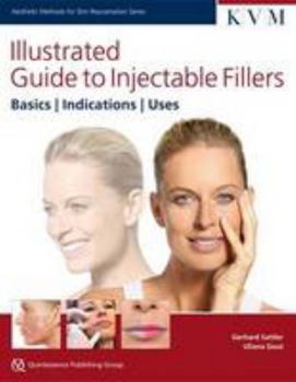 Hardcover Illustrated Guide to Injectable Fillers: Basics, Indications, Uses (Aesthetic Methods for Skin Rejuvenation) Book