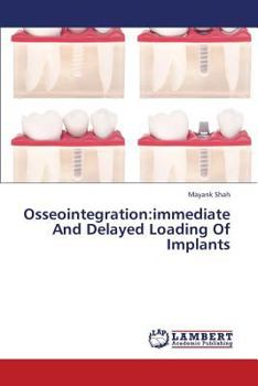 Paperback Osseointegration: Immediate and Delayed Loading of Implants Book