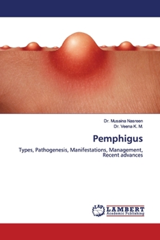 Paperback Pemphigus Book