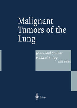 Paperback Malignant Tumors of the Lung: Evidence-Based Management Book