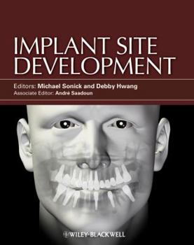 Hardcover Implant Site Development Book