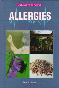 Library Binding Allergies Book