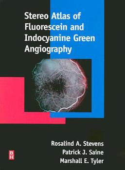 Hardcover Stereo Atlas of Fluorescein and Indocyanine Green Angiography Book