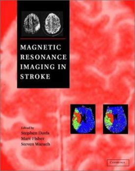 Hardcover Magnetic Resonance Imaging in Stroke Book