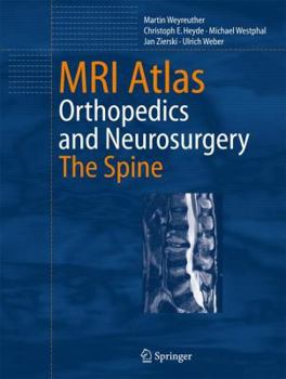 Hardcover MRI Atlas: Orthopedics and Neurosurgery, the Spine Book