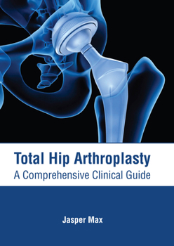 Hardcover Total Hip Arthroplasty: A Comprehensive Clinical Guide Book