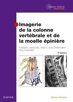 Hardcover Imagerie de La Colonne Vertebrale Et de La Moelle Epiniere [French] Book
