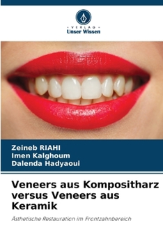 Paperback Veneers aus Kompositharz versus Veneers aus Keramik [German] Book