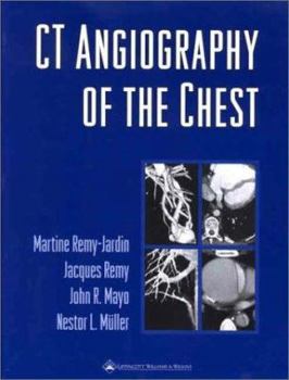 Hardcover CT Angiography of the Chest Book