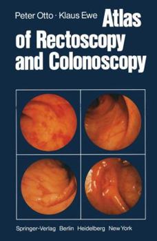 Paperback Atlas of Rectoscopy and Coloscopy Book