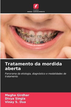 Paperback Tratamento da mordida aberta (Portuguese Edition) [Portuguese] Book