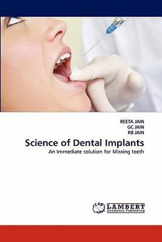 Paperback Science of Dental Implants Book