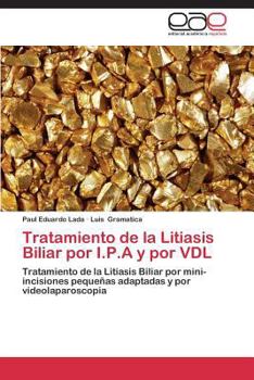 Paperback Tratamiento de la Litiasis Biliar por I.P.A y por VDL [Spanish] Book