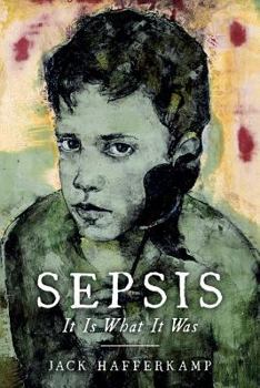 Paperback Sepsis: It Is What It Was Book