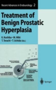 Hardcover Treatment of Benign Prostatic Hyperplasia Book