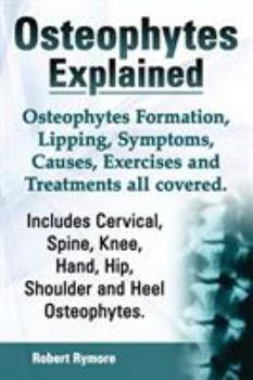 Paperback Osteophytes Explained. Osteophytes Formation, Lipping, Symptoms, Causes, Exercises and Treatments All Covered. Includes Cervical, Spine, Knee, Hand, H Book