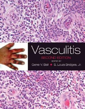 Hardcover Vasculitis Book