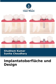 Paperback Implantatoberfläche und Design [German] Book