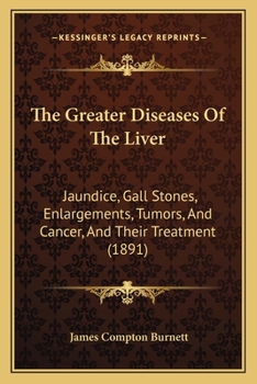 Paperback The Greater Diseases Of The Liver: Jaundice, Gall Stones, Enlargements, Tumors, And Cancer, And Their Treatment (1891) Book