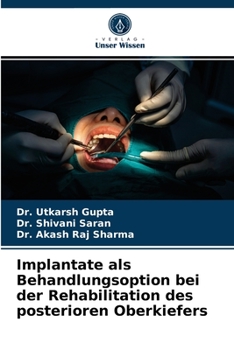 Paperback Implantate als Behandlungsoption bei der Rehabilitation des posterioren Oberkiefers [German] Book