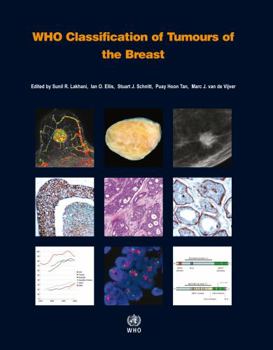 Paperback Who Classification of Tumours of the Breast [op] Book