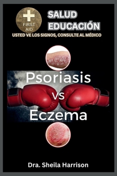 Psoriasis vs. Eczema: Diferencias, Similitudes, Tipos, Síntomas, Causas, Diagnóstico, Tratamiento, Medicamentos, Prevención y Control, Manejo (ESTANTE ... SIGNOS, USTED VE AL MÉDICO) (Spanish Edition)