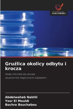 Paperback Gruźlica okolicy odbytu i krocza [Polish] Book