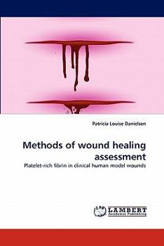 Paperback Methods of wound healing assessment Book