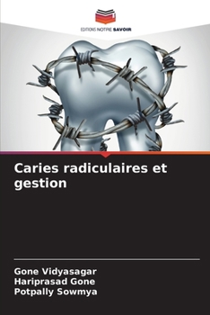 Paperback Caries radiculaires et gestion [French] Book