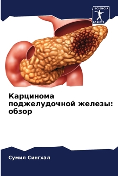 Paperback Карцинома поджелудочно&# [Russian] Book