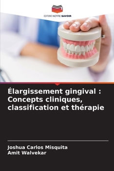 Élargissement gingival: Concepts cliniques, classification et thérapie
