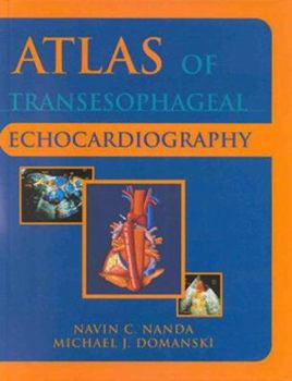 Hardcover Atlas of Transesophageal Echocardiography Book