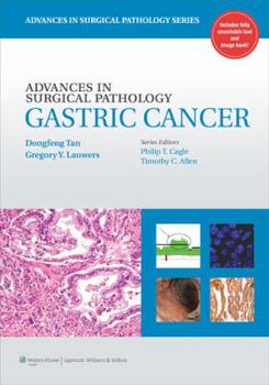 Hardcover Gastric Cancer (Advances in Surgical Pathology) Book
