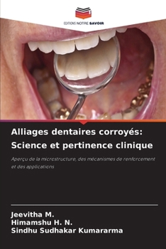 Alliages dentaires corroyés: Science et pertinence clinique (French Edition)