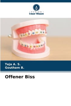 Offener Biss (German Edition)