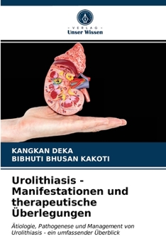 Paperback Urolithiasis - Manifestationen und therapeutische Überlegungen [German] Book