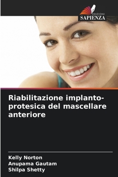 Paperback Riabilitazione implanto-protesica del mascellare anteriore [Italian] Book