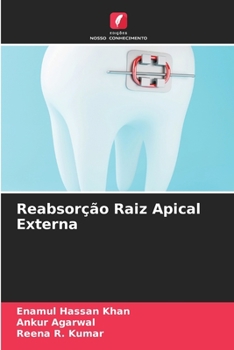 Paperback Reabsorção Raiz Apical Externa [Portuguese] Book